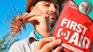 How to Cure a Lionfish Sting!