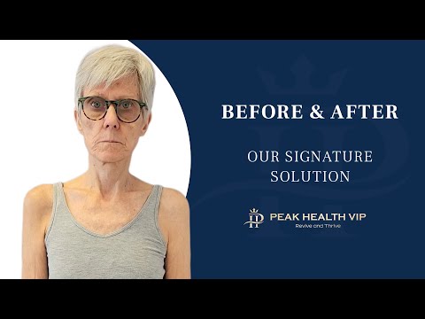 “Slightly Easier, Finally Moving Again” – Shoulder Pain Recovery at Peak Health VIP