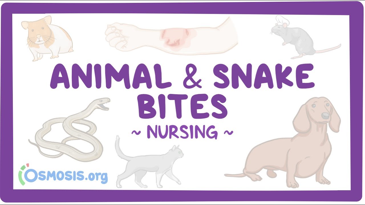 Animal & snake bites: Clinical Nursing Care