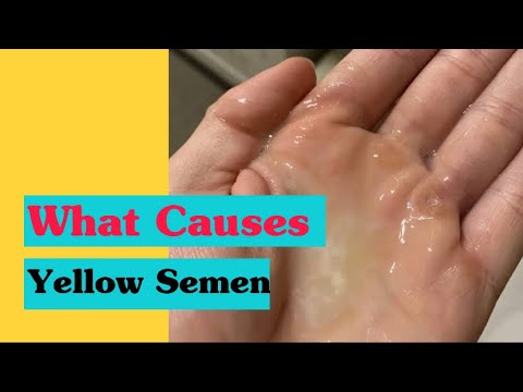 Yellow Semen|Causes|Symptom Checker