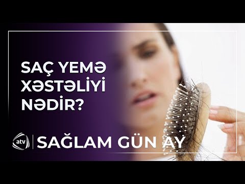 "Mədə problemlərinə yol açır" - Saç yolma pozuntusu nədir?