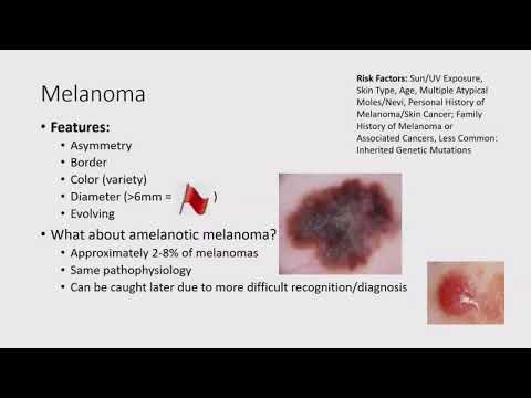 Lumps, Bumps and Surprises