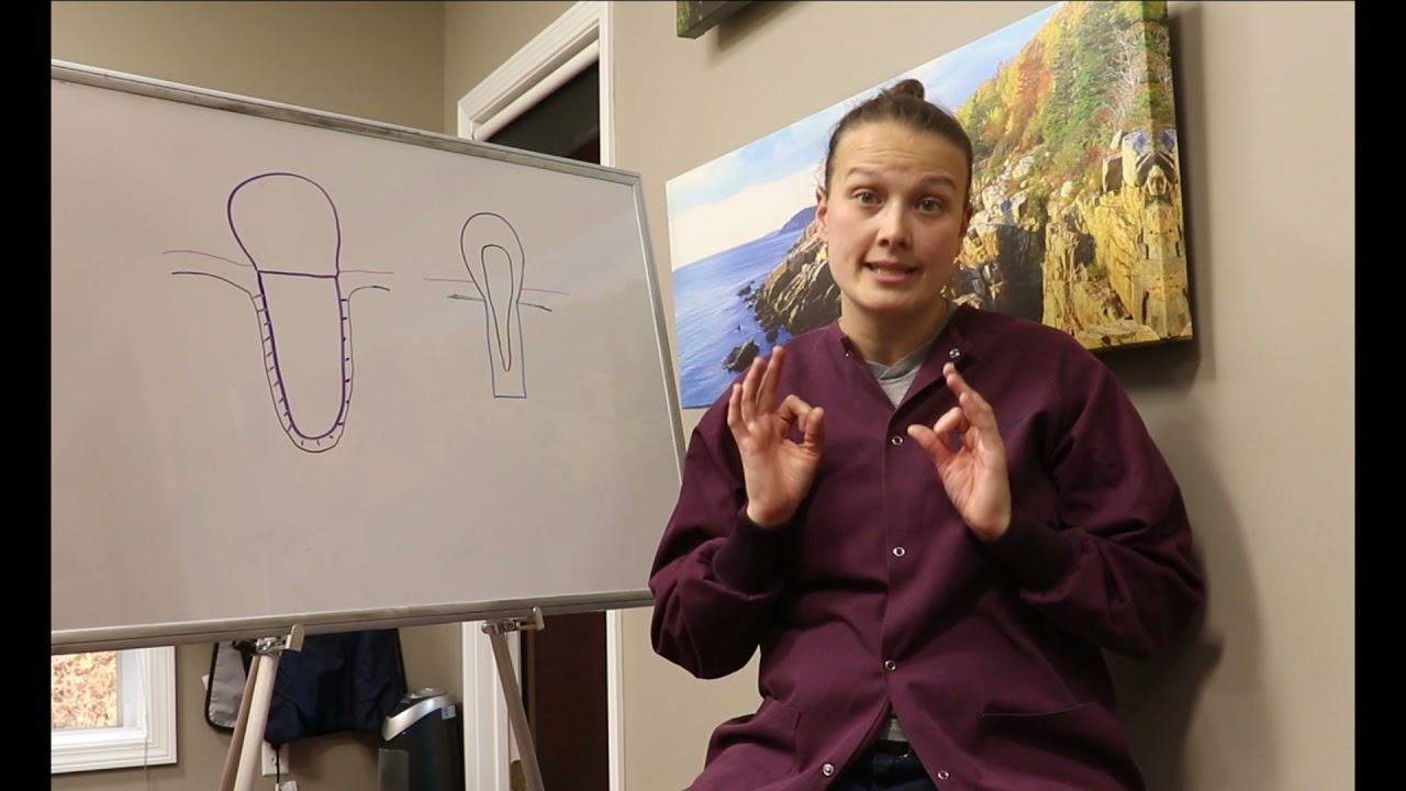 Things to know about Dental Implants