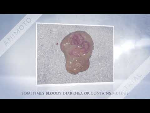 download lagu mp3 mp4 Shigella Food Poisoning Outbreak, download lagu Shigella Food Poisoning Outbreak gratis, unduh video klip Shigella Food Poisoning Outbreak