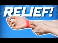 What They Don't Tell You About Carpal Tunnel Syndrome! Stretches & Treatments