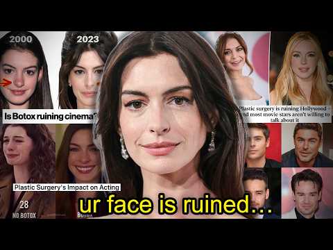 YOU'RE NOT AN ACTOR, YOU'RE JUST BOTCHED...