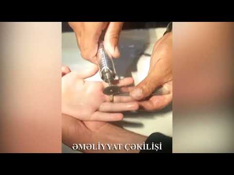 FHN Mətbuat xidmətinin məlumatı (video)