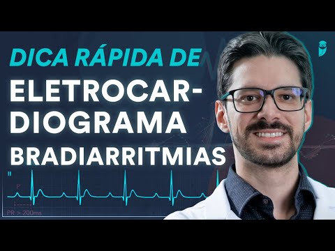 Dica rápida de Eletrocardiograma sobre Bradiarritmias | Estratégia Eletro