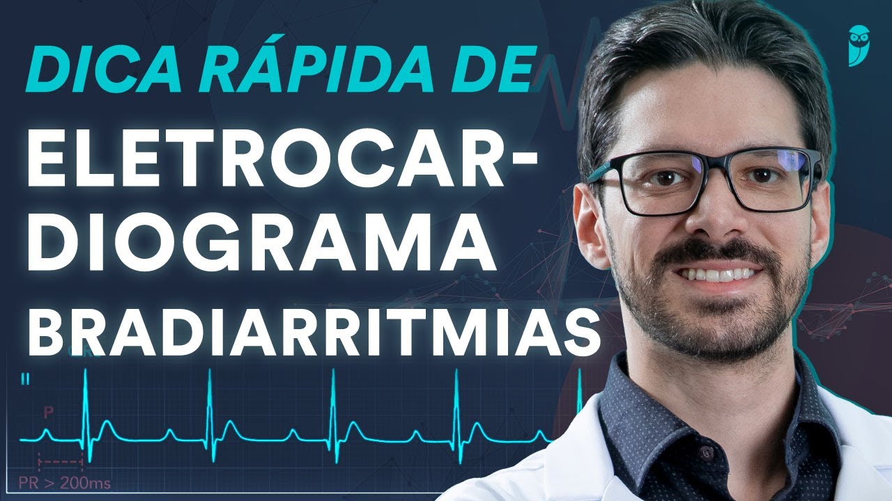 Dica rápida de Eletrocardiograma sobre Bradiarritmias | Estratégia Eletro