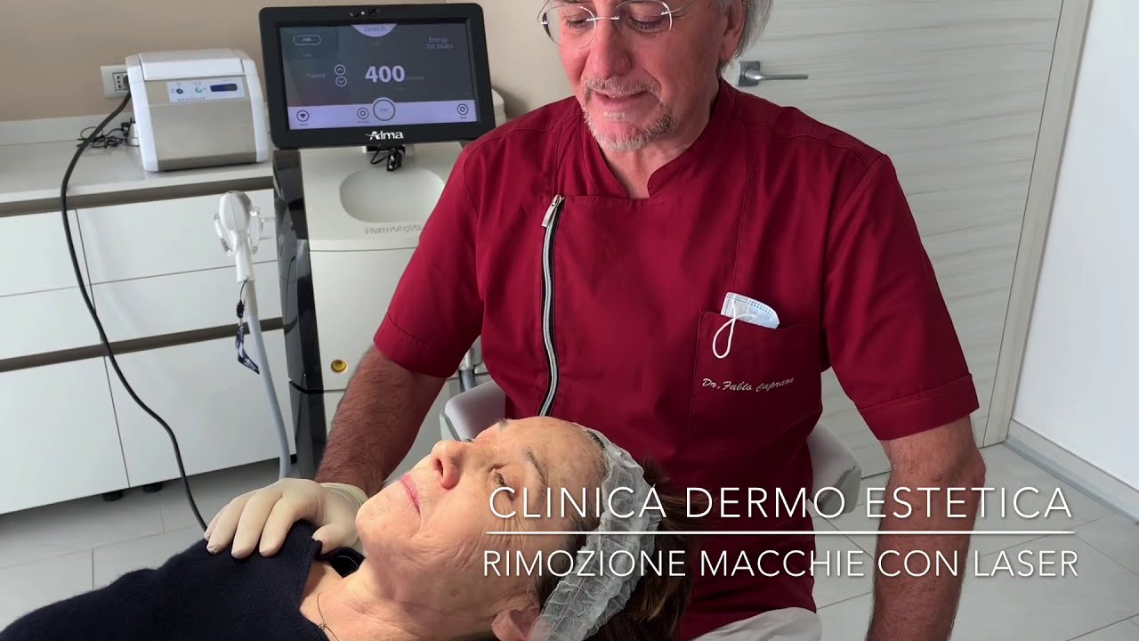 Eliminazione macchie viso e mani con laser Q-Switched ( prima seduta)