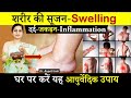 शरीर की सूजन दूर करने के आयुर्वेदिक उप