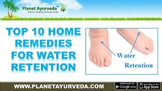 Top 10 Home Remedies for #Edema (Water Retention) | Natural Treatment