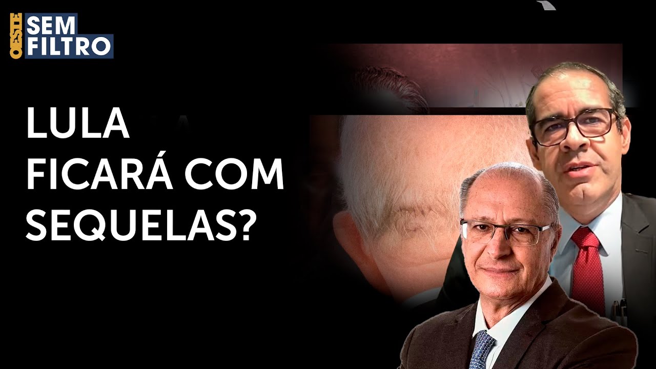 EXCLUSIVO: neurocirurgião Paulo Porto de Melo explica quadro de Lula após cirurgia emergencial