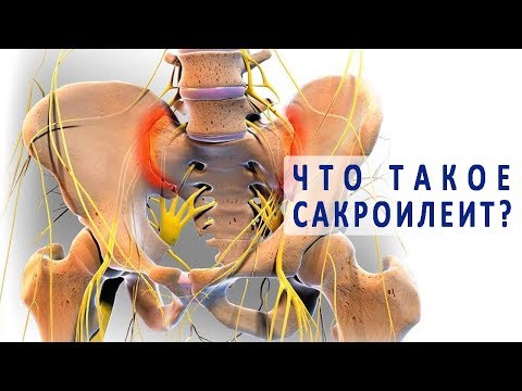 Артроз суставов лечение хозяйственным мылом Болит в области поясницы спины слева