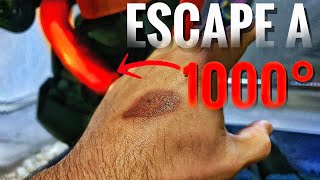 Me quemo la mano con el Tubo de Escape de mi moto, como curar quemaduras