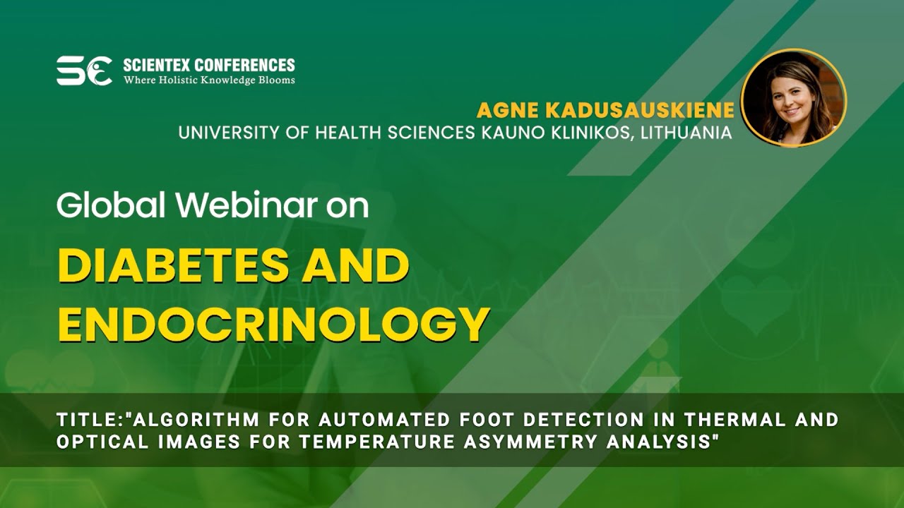 Algorithm for automated foot detection in thermal and optical images for temperature asymmetry analysis