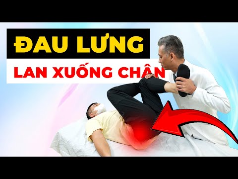Đau Lưng Lan Xuống Chân Khiến Bạn Mất Ngủ? Bác Sĩ Chỉ Cách Hết Đau