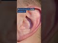 Tinnitus EXPOSED Surprising Causes Of Ringing In Ears 6