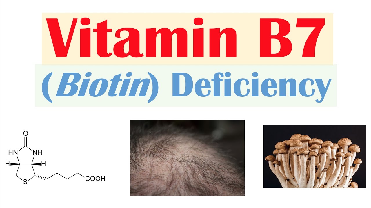 Vitamin B7 Biotin Deficiency | Sources, Purposes, Causes, Symptoms, Diagnosis, Treatment