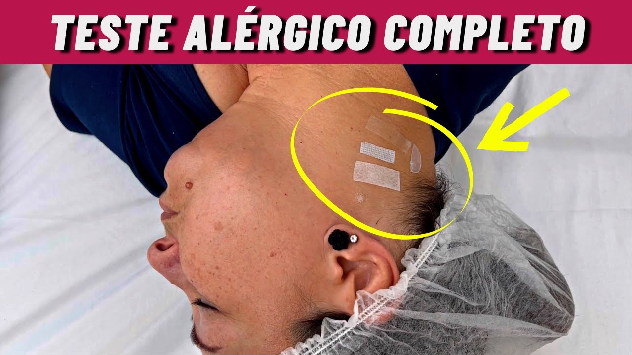 ✅COMO FAZER O TESTE ALÉRGICO DE EXTENSÃO DE CÍLIOS