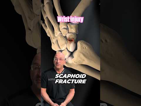Frequently Misdiagnosed Reason Your Wrist Hurts #shorts