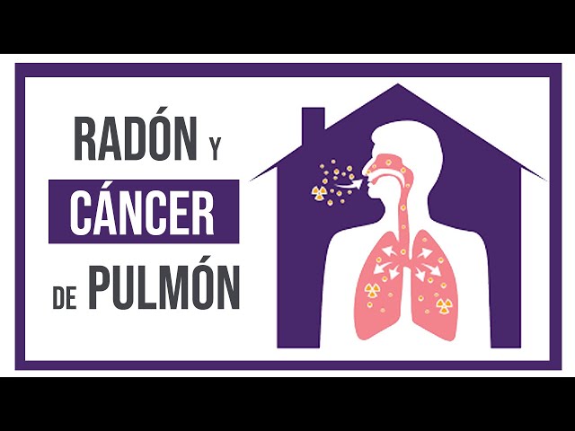 Vídeo relacionado con OP/335-Radón y cáncer de pulmón (SIN COLECCION)