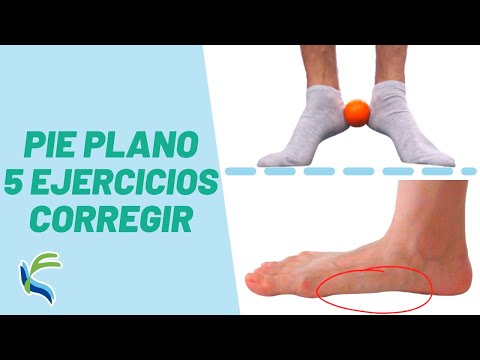 Corrige El Pie Plano Haciendo Estos Ejercicios