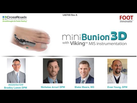 miniBunion 3D FootInnovate Webinar - August 30th - Hosted By Brad Lamm, DPM