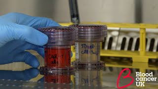 This is blood cancer: research