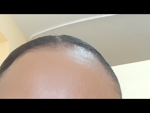 My Dads Urgent Surgery..0703663477 Caroline' Mwaura