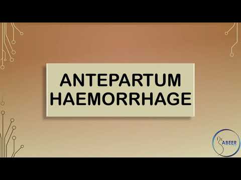 RCOG GUIDELINE Antepartum Haemorrhage Part 1