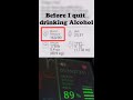 Quit Drinking = Better Blood Pressure