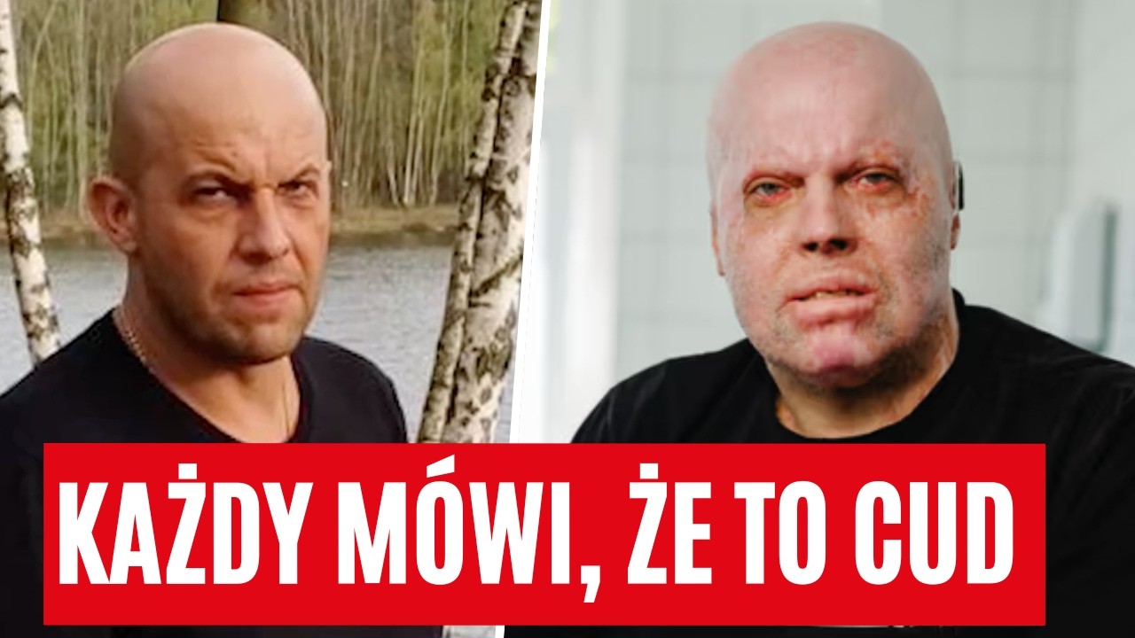 Prośba o modlitwę za Mirosława który przeżył straszny wypadek w kopalni