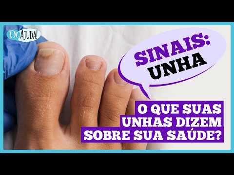 Unhas Fracas: Sinal de Alerta para a Sua Saúde? Descubra o Que Elas Revelam!