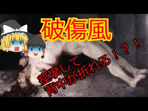 破傷風菌について詳しく解説