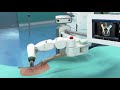 Robotic spine surgery with Mazor X