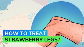 What Are Strawberry Legs? Here’s How to Get Rid of Them