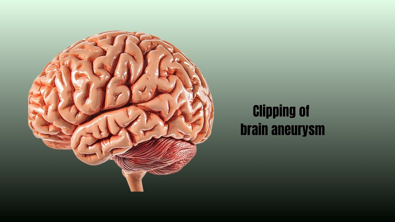 David Tafur Muñoz-2497