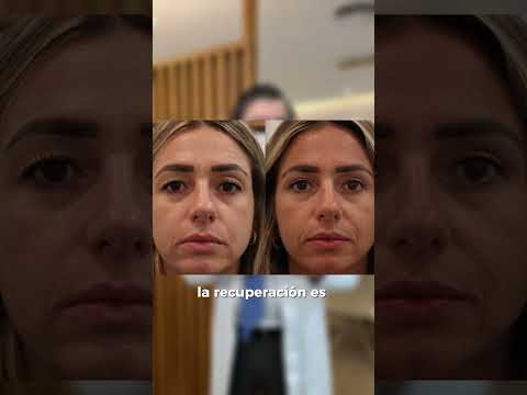 Juan Antonio Troyano Rivas-24