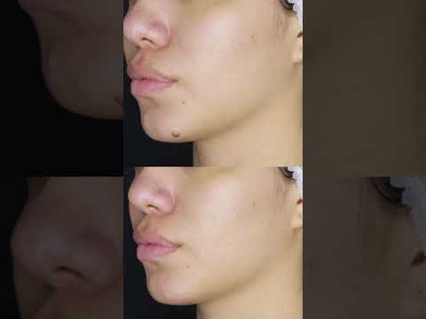 video n4a5n45Vkv8