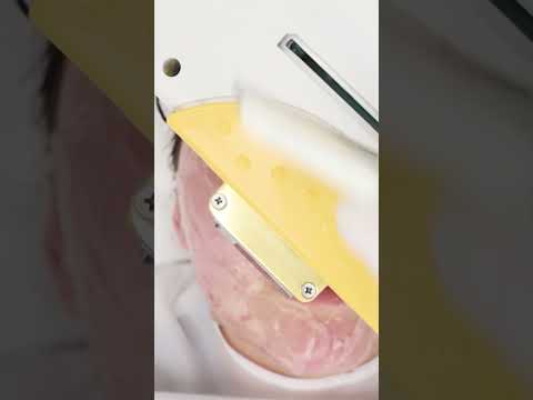 ✨ Usuwanie przebarwień – urządzenie. Skuteczność i precyzja! ✨