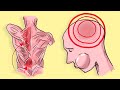 The Symptoms of General Anxiety and Panic Disorder