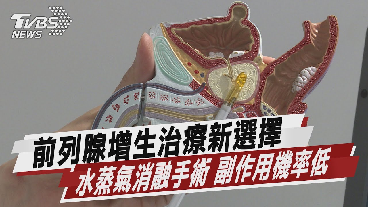 前列腺肥大治療新選擇 「水蒸氣消融手術」快速風險低