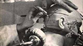 Dystronic - Human Device