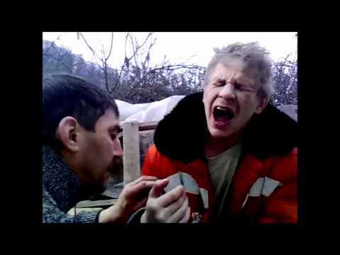 Wyrywanie zęba kombinerkami