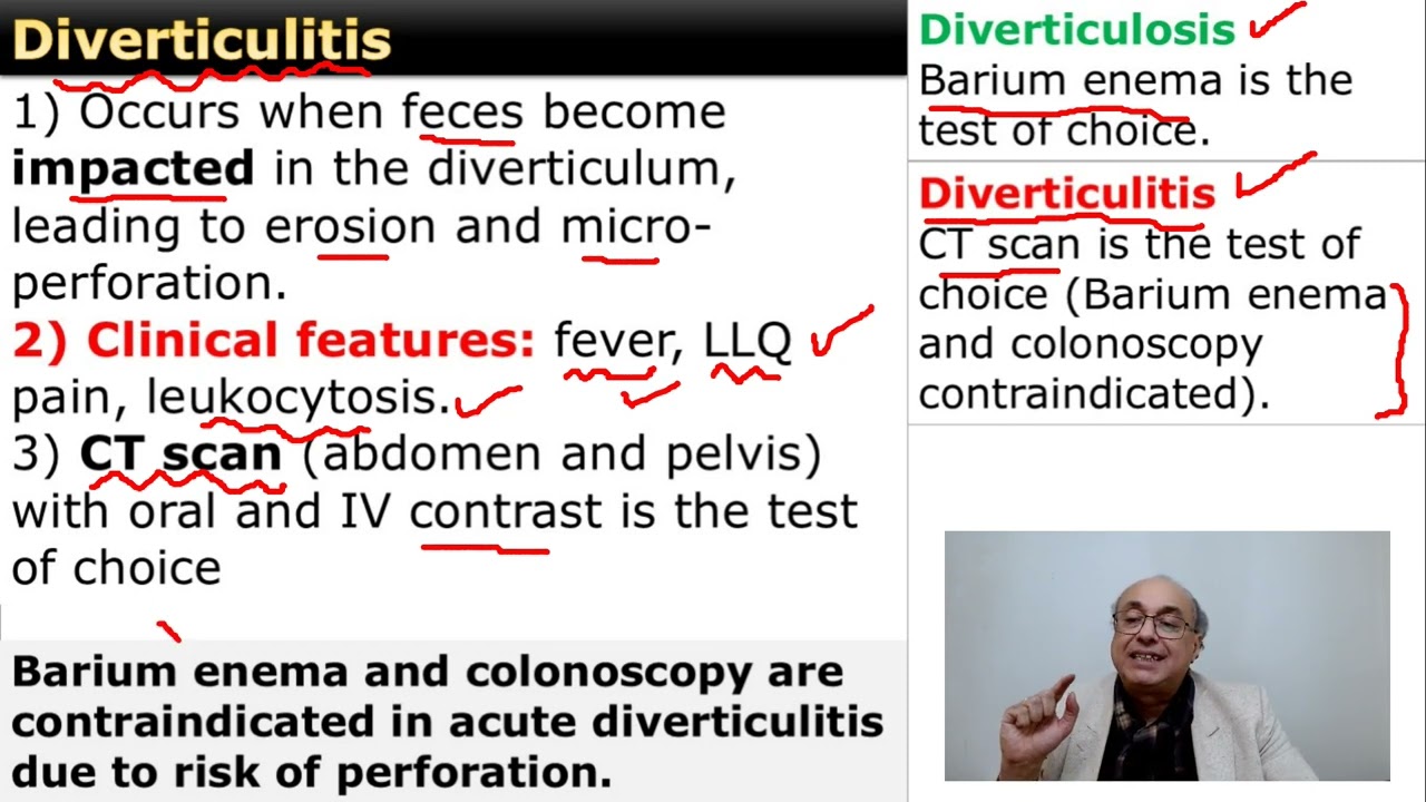 Diverticulosis and Diverticulitis