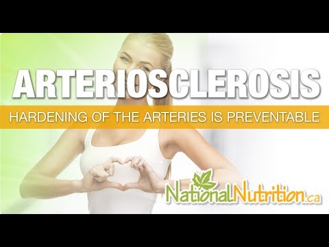 Atherosclerosis Treatment And Prevention - Cardiovascular Disease - Natural Health Reviews Canada