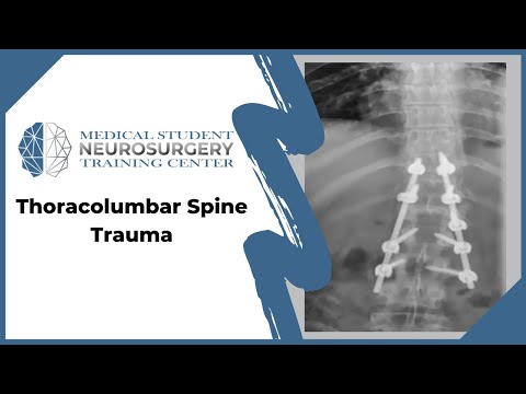 Thoracolumbar Spine Trauma