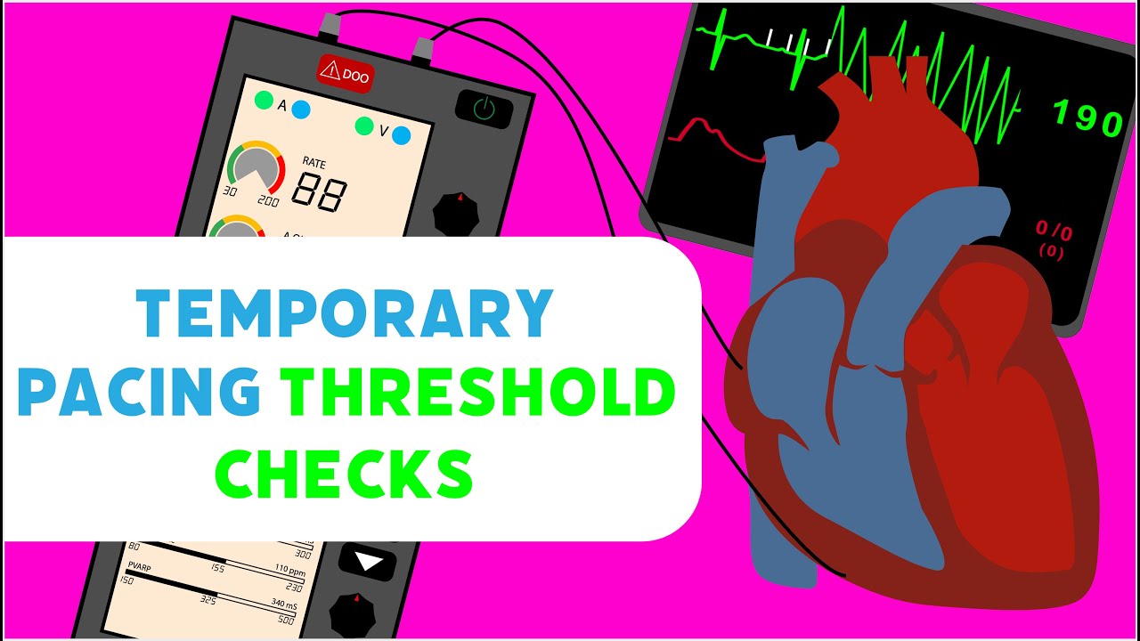 Temporary Pacing Threshold Checks
