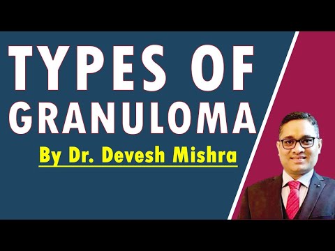 Types of Granuloma by Dr. Devesh Mishra